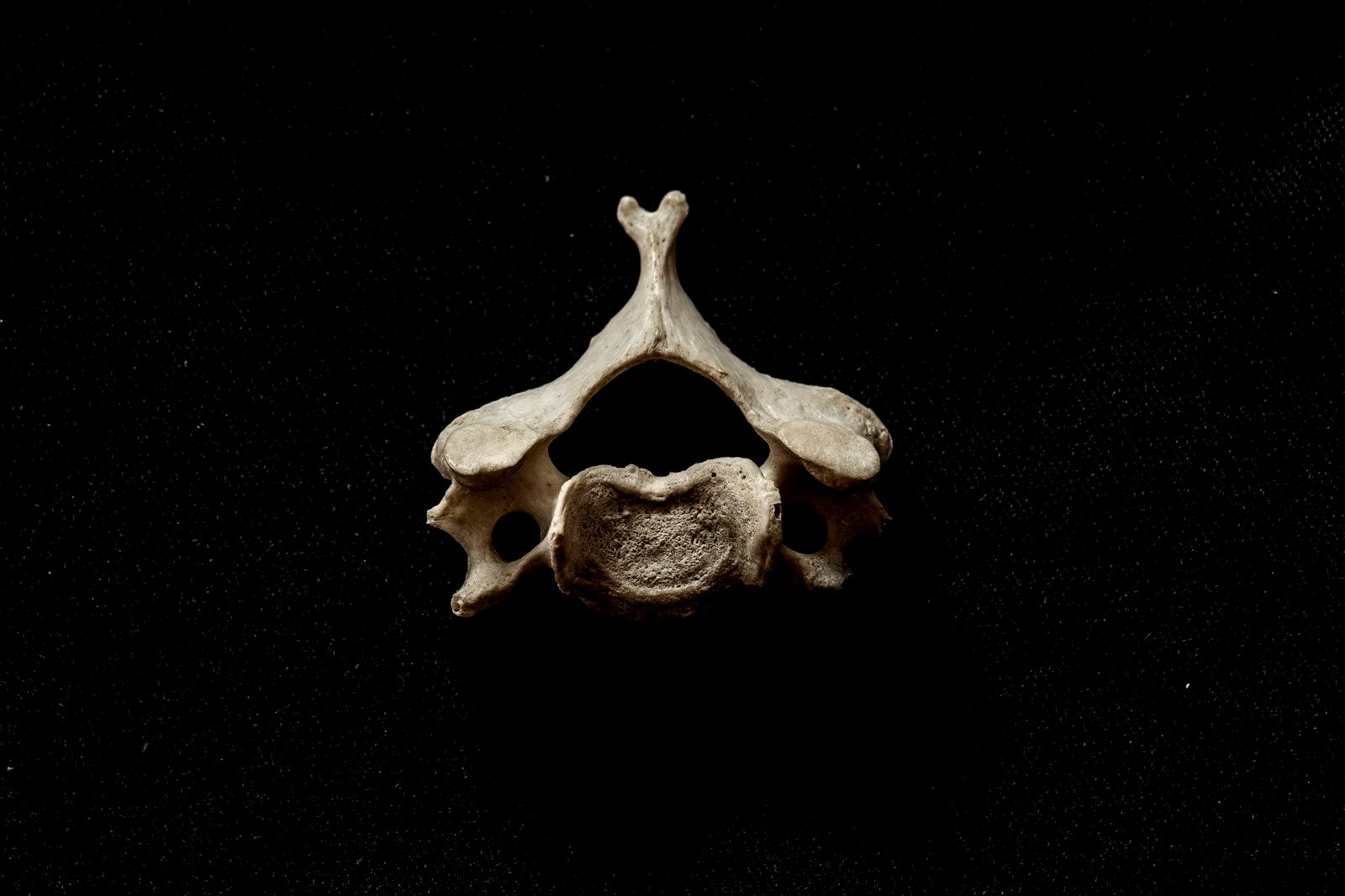 Close-up of a single vertebra